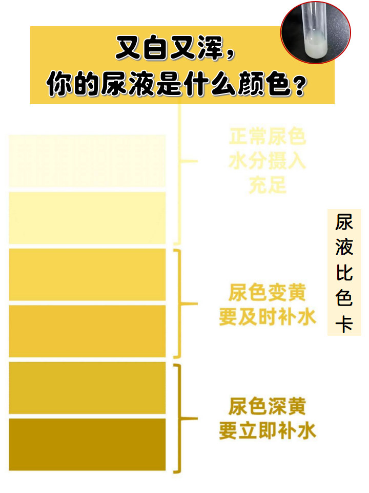 尿混浊是怎么回事?怎么办?