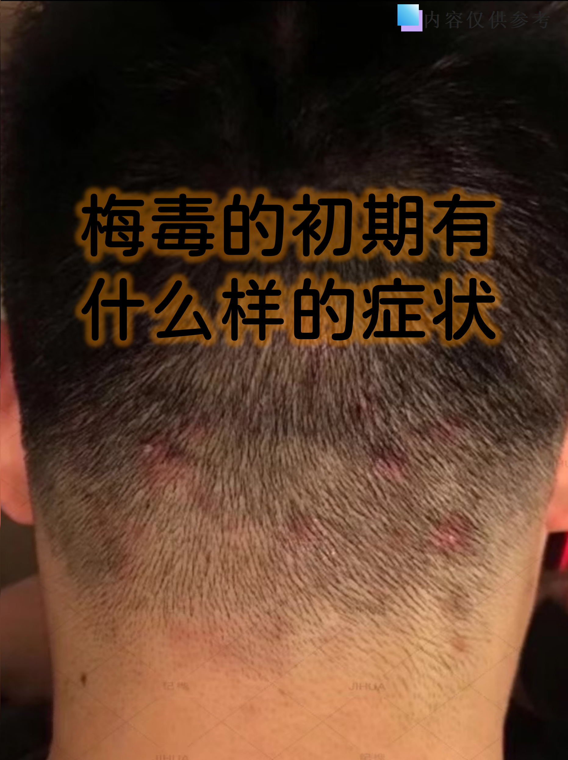 性病都有什么症状