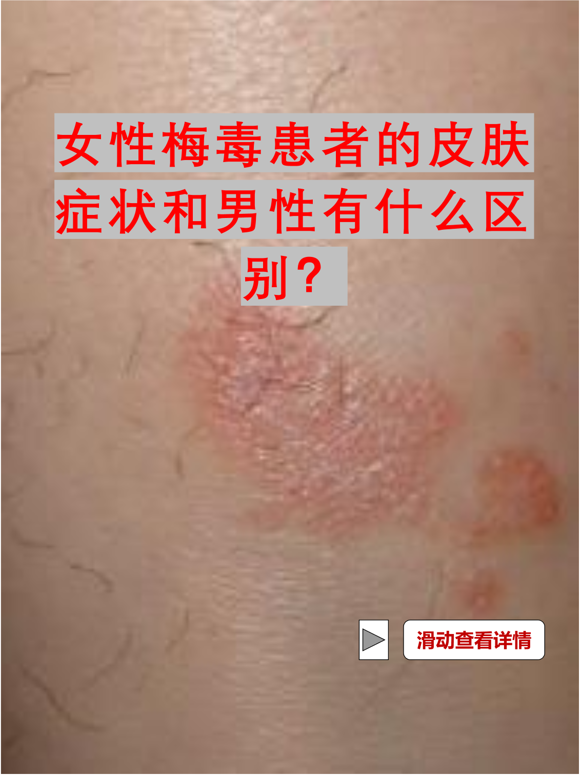 性病都有什么症状