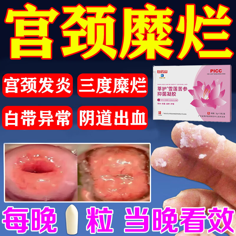 治糜灵栓的用法