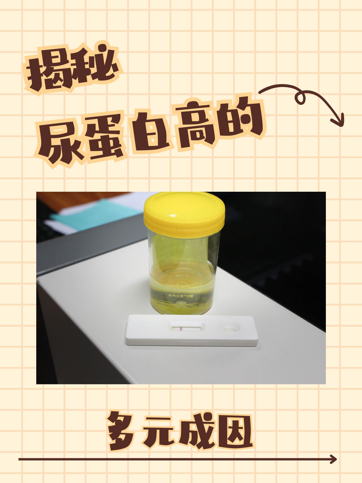 体检尿蛋白两个加号