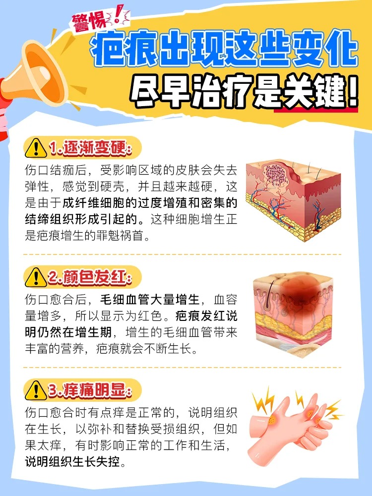 败血症是怎么引起的?