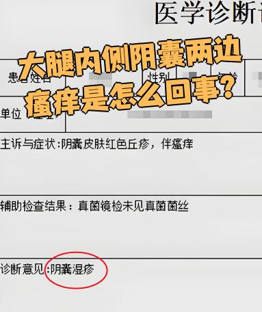 大腿内侧瘙痒怎么回事