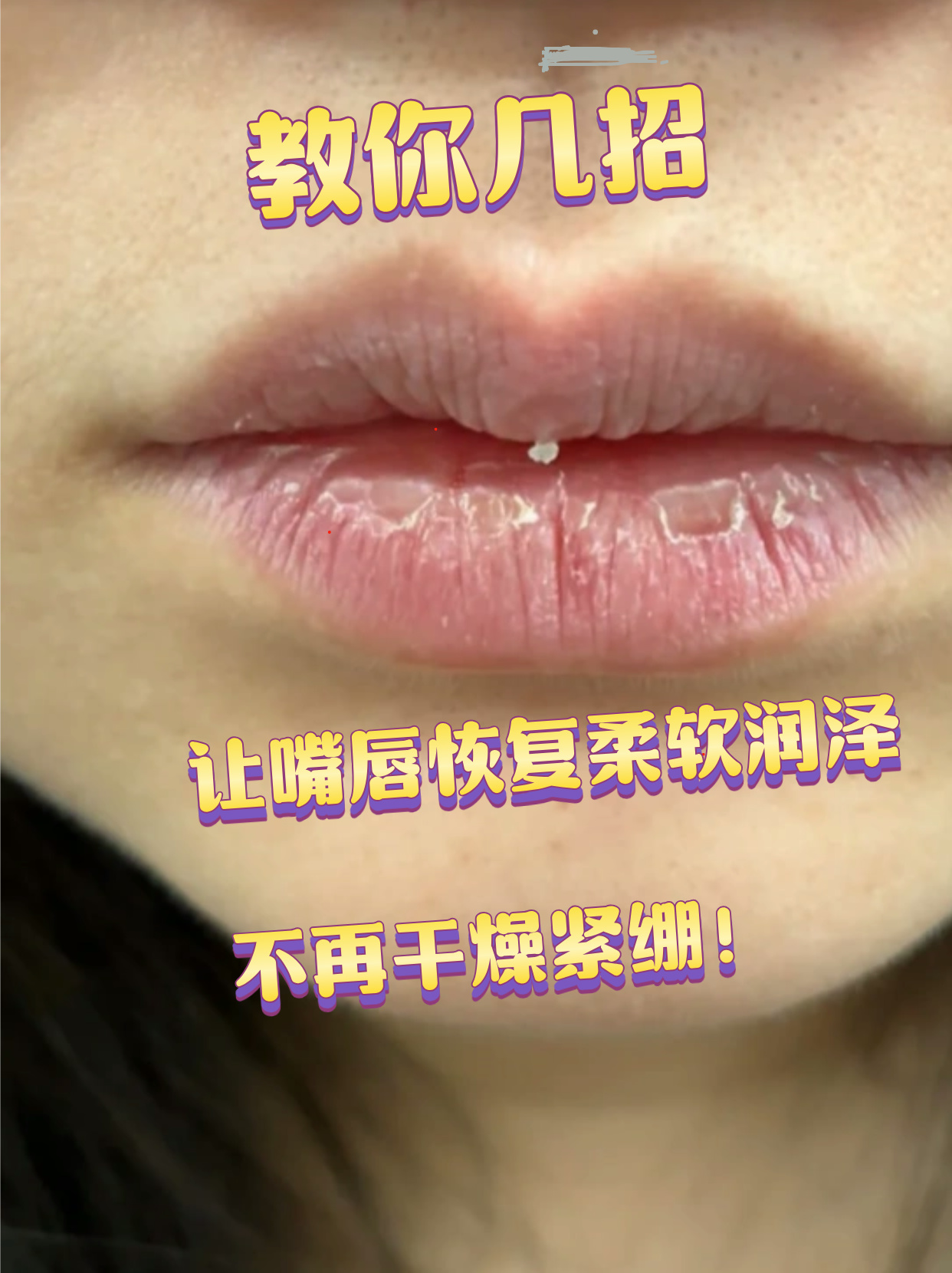 嘴巴整形会有副作用吗?