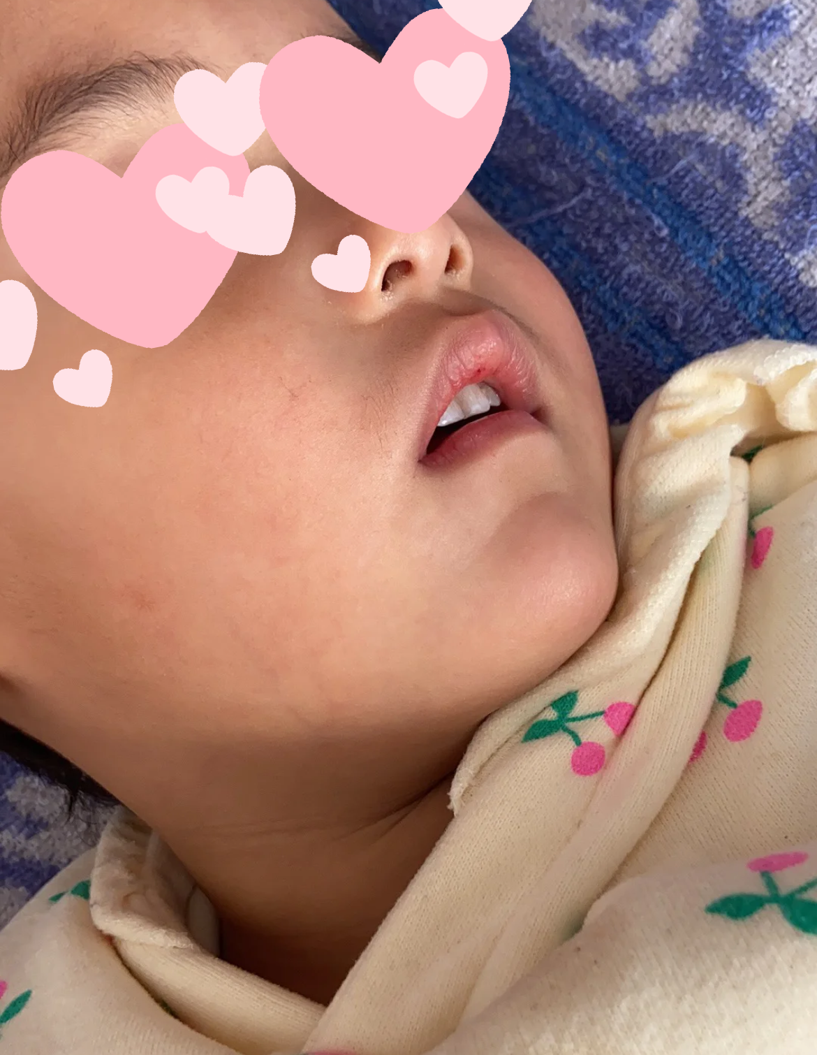 7岁小孩睡觉打呼噜