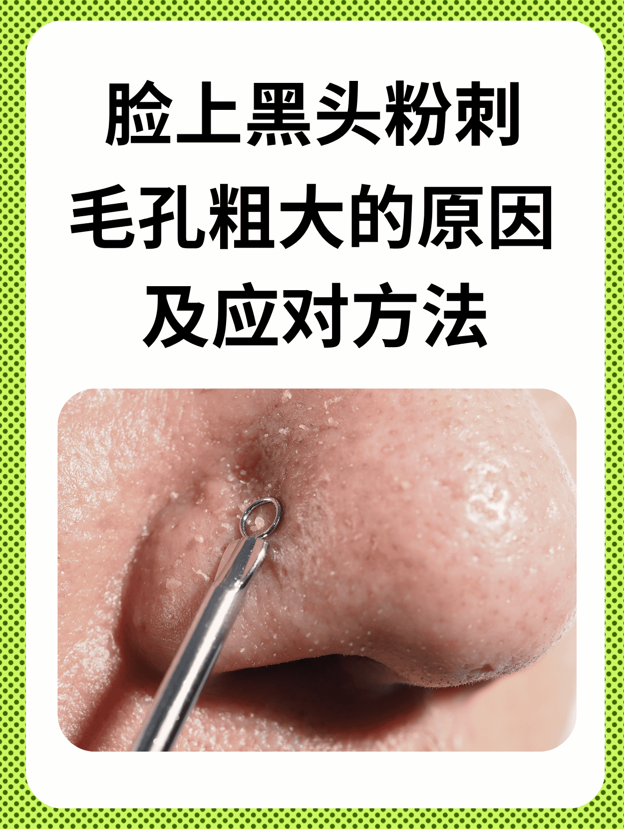 脸上毛孔堵塞怎么办