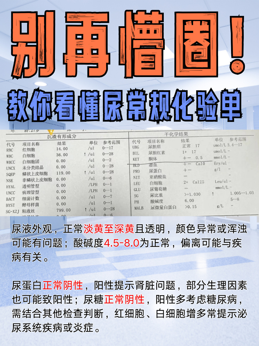 尿常规检查的注意事项