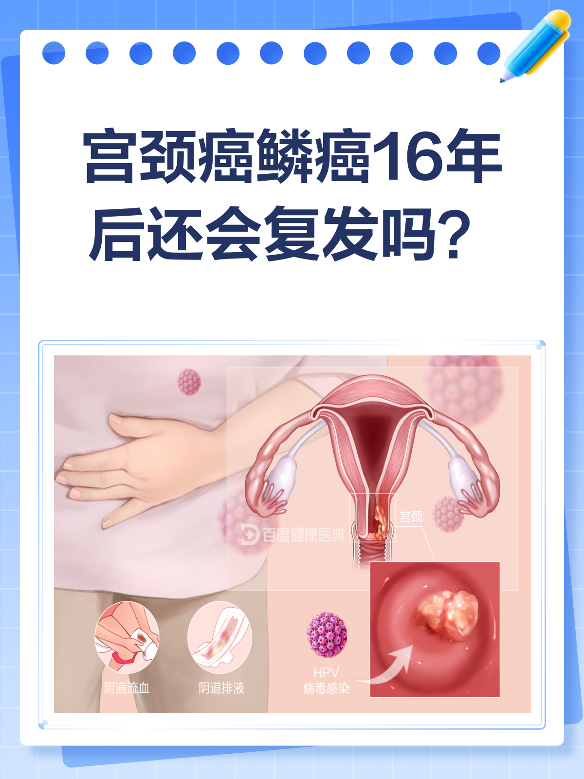 宫颈鳞状细胞癌恶性程度高吗