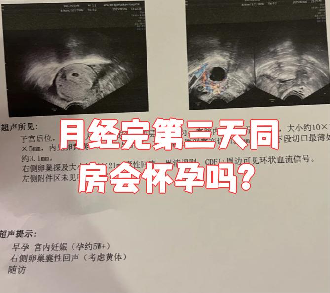 月经干净的第三天同房会怀孕吗