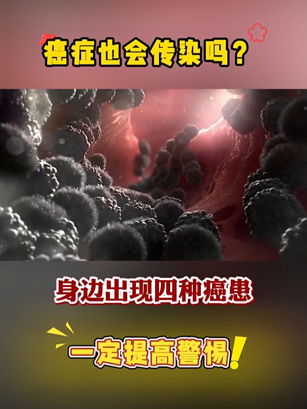 癌症会传染吗