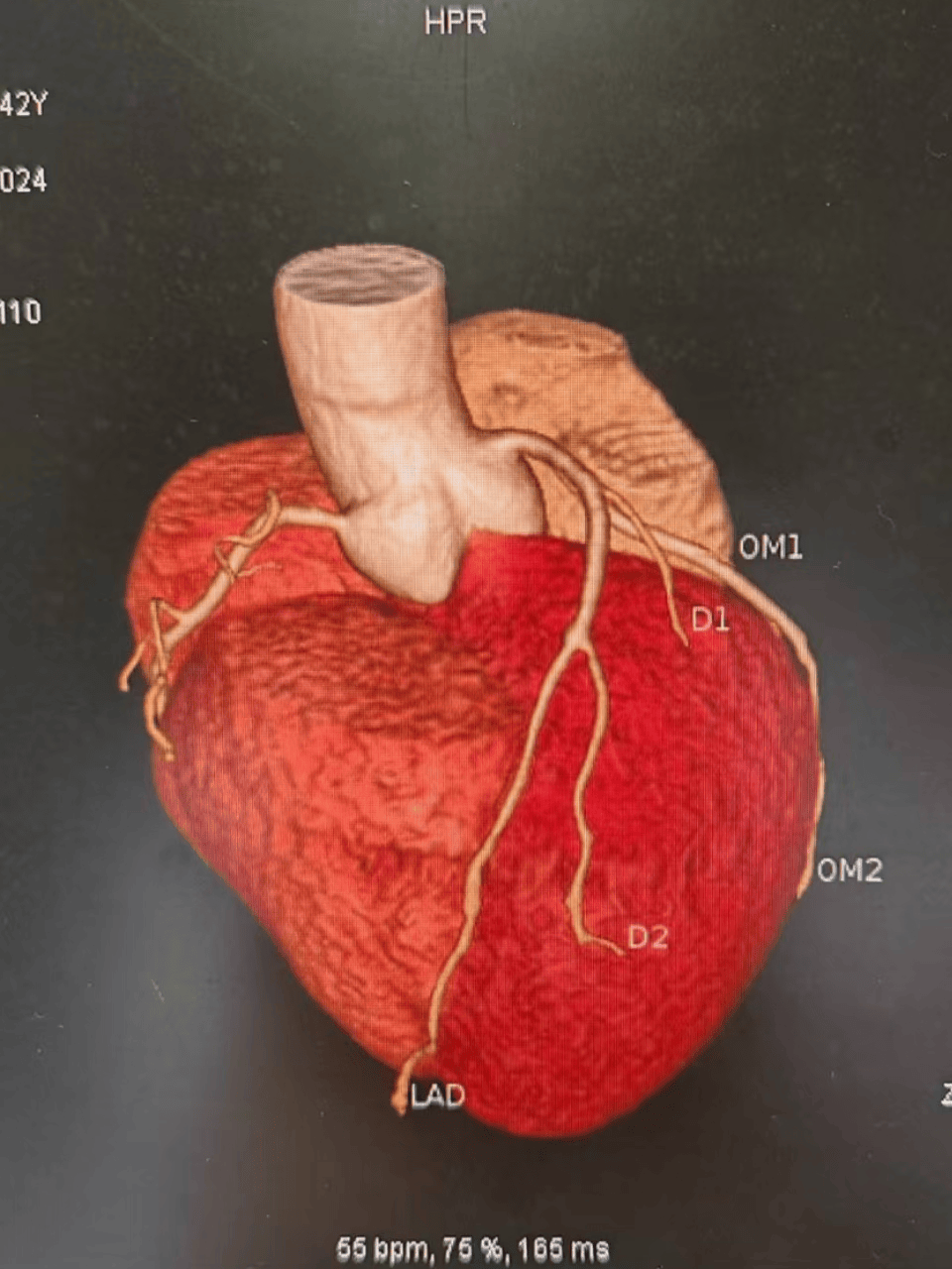 心脏造影有危险吗