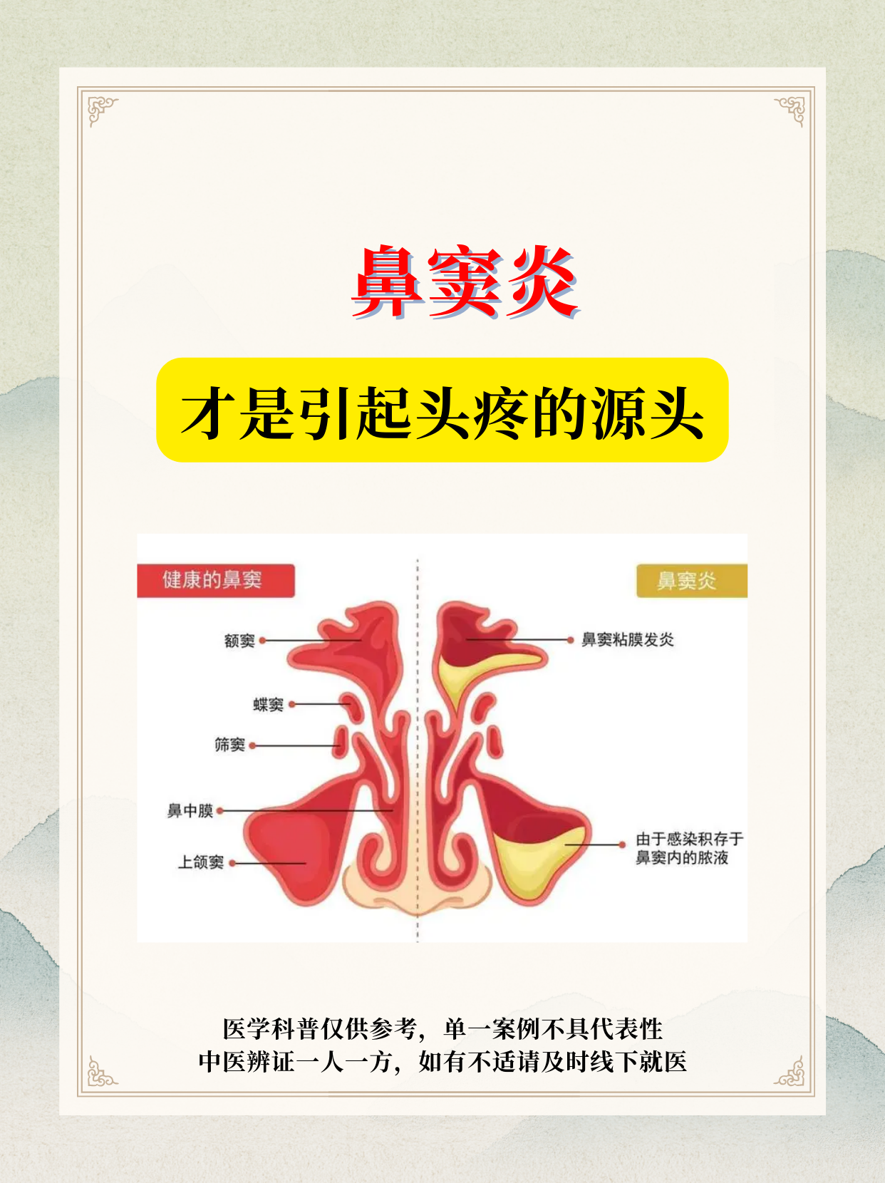 鼻窦炎头疼头晕怎么办