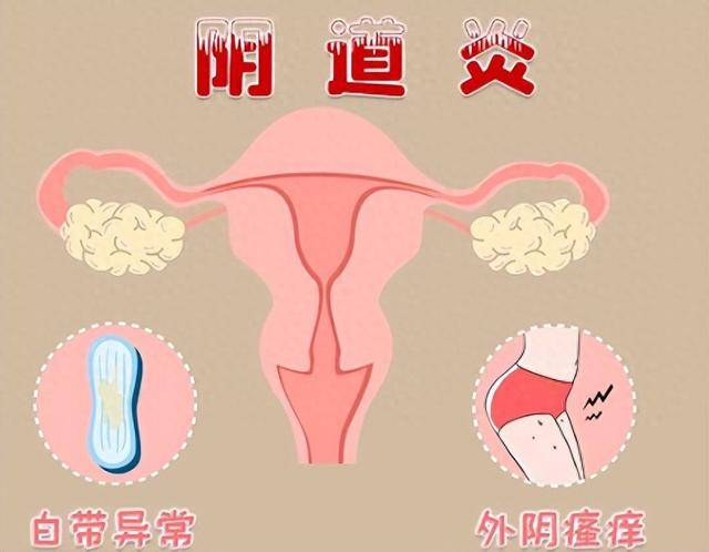 外阴炎的主要症状