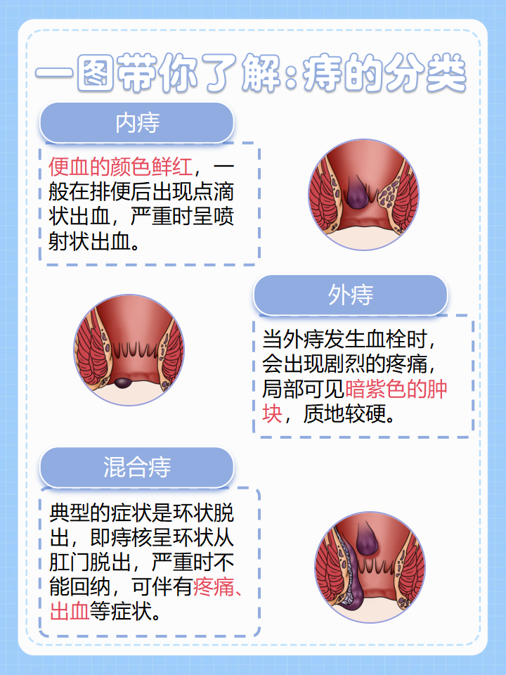 内痔出血该怎么办