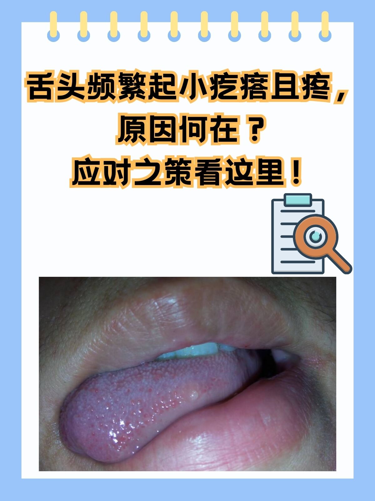 舌头有红点是什么回事