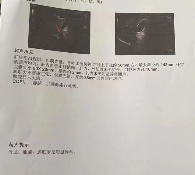 肝胆胰脾彩超查什么