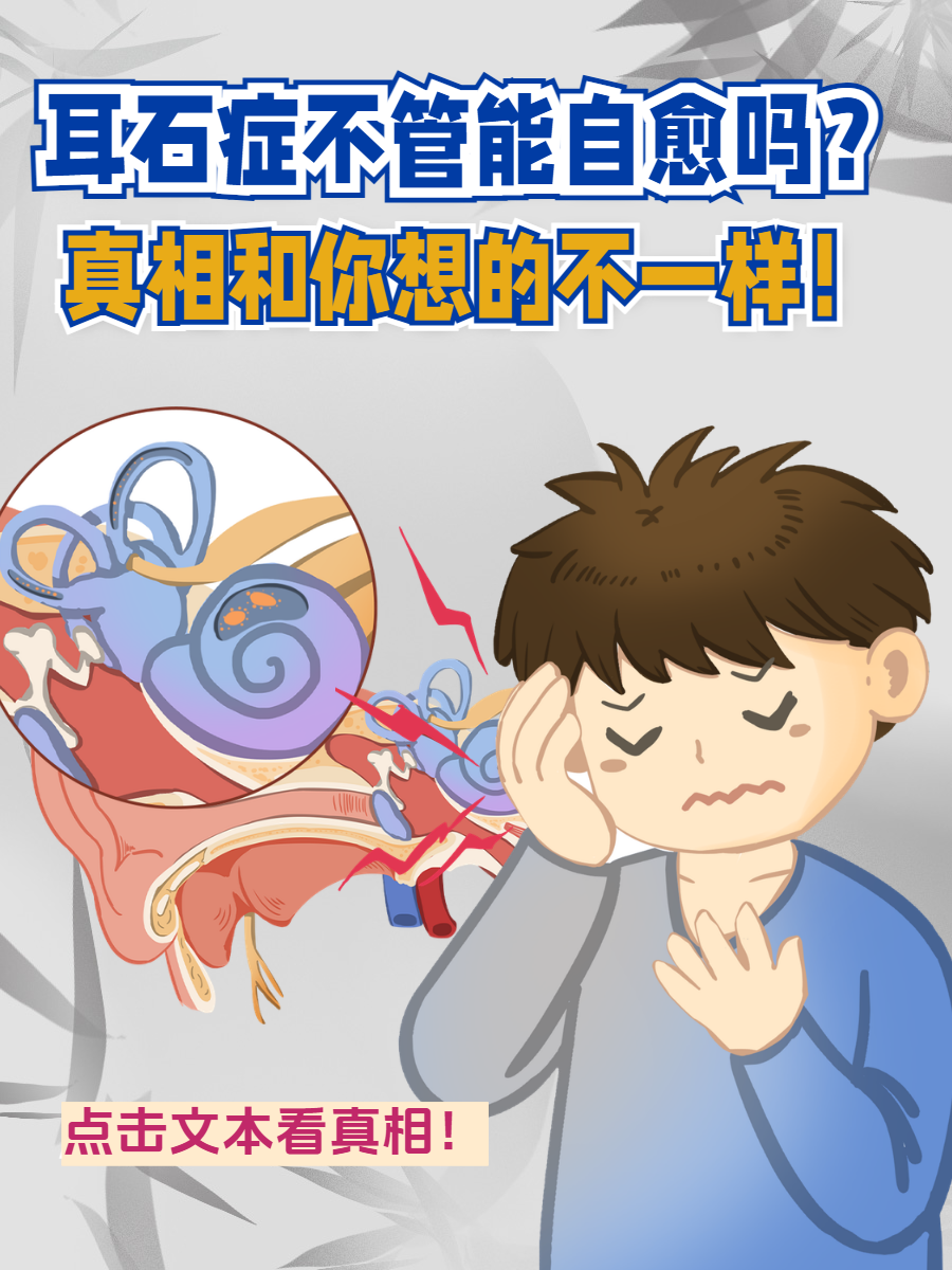 耳石症能自愈吗