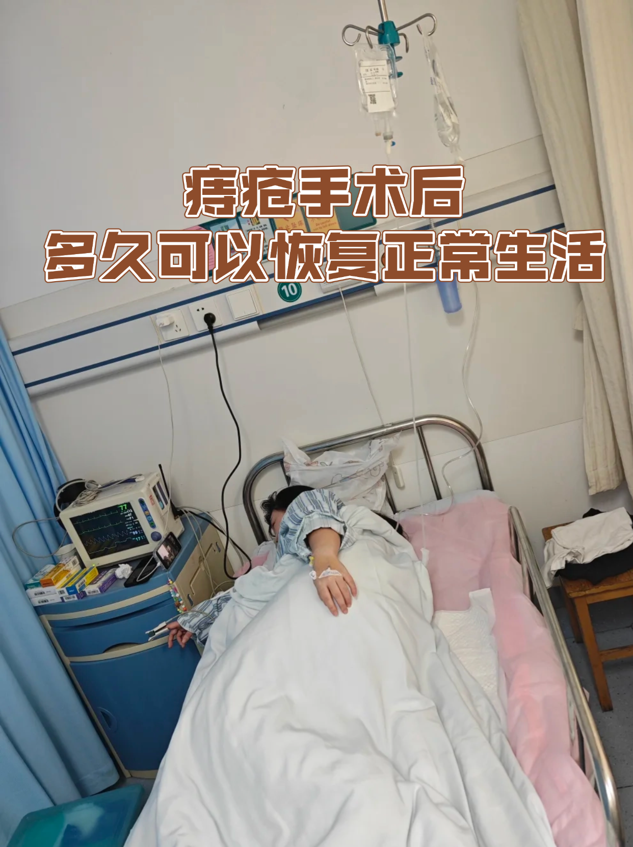 痔疮手术要多长时间