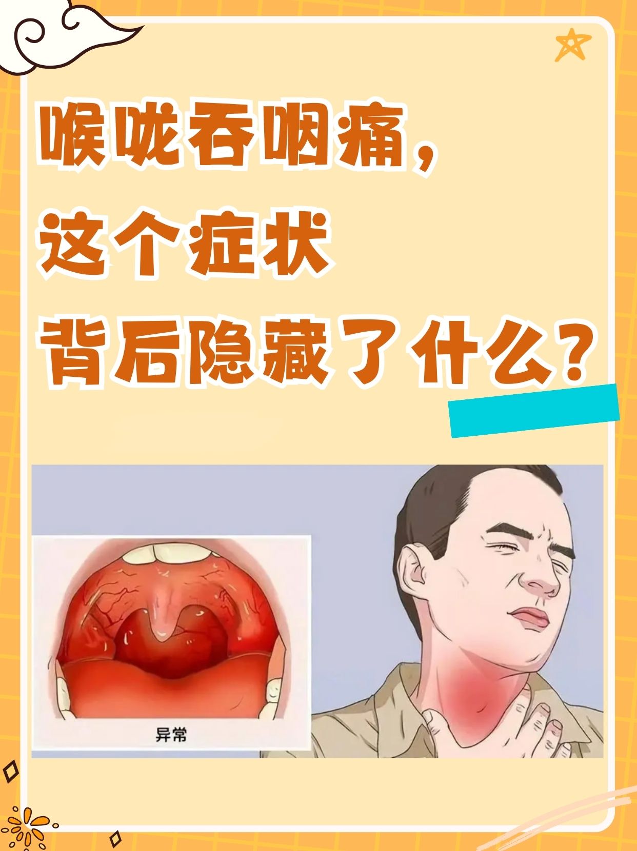 喉咙痛是怎么回事