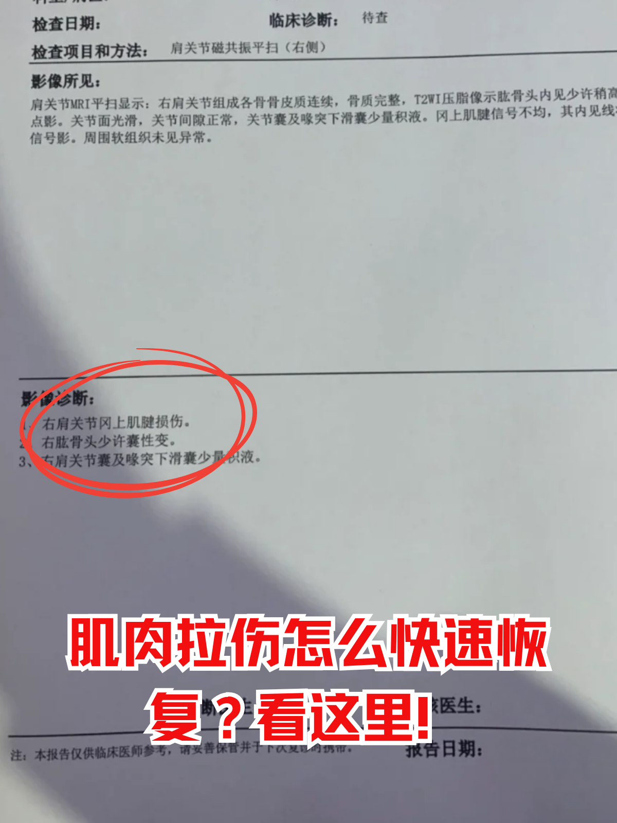 肌肉拉伤怎么快速恢复