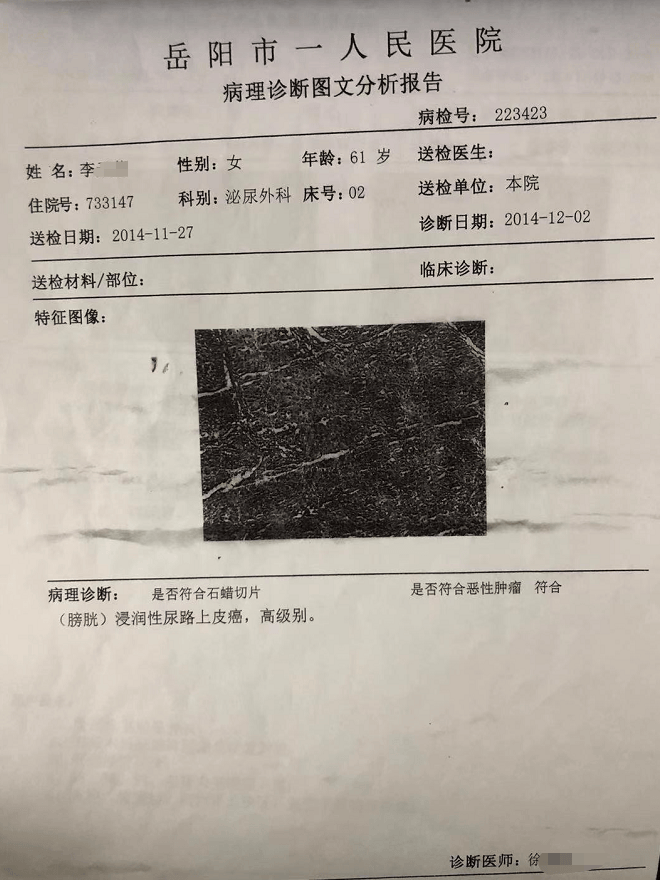 肾癌晚期能活多久