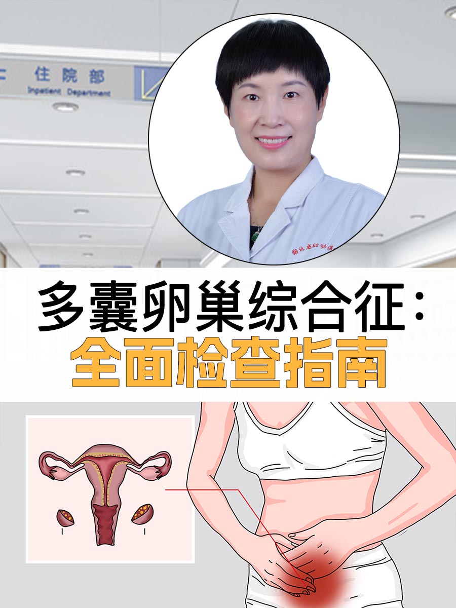 多囊卵巢综合征有什么表现