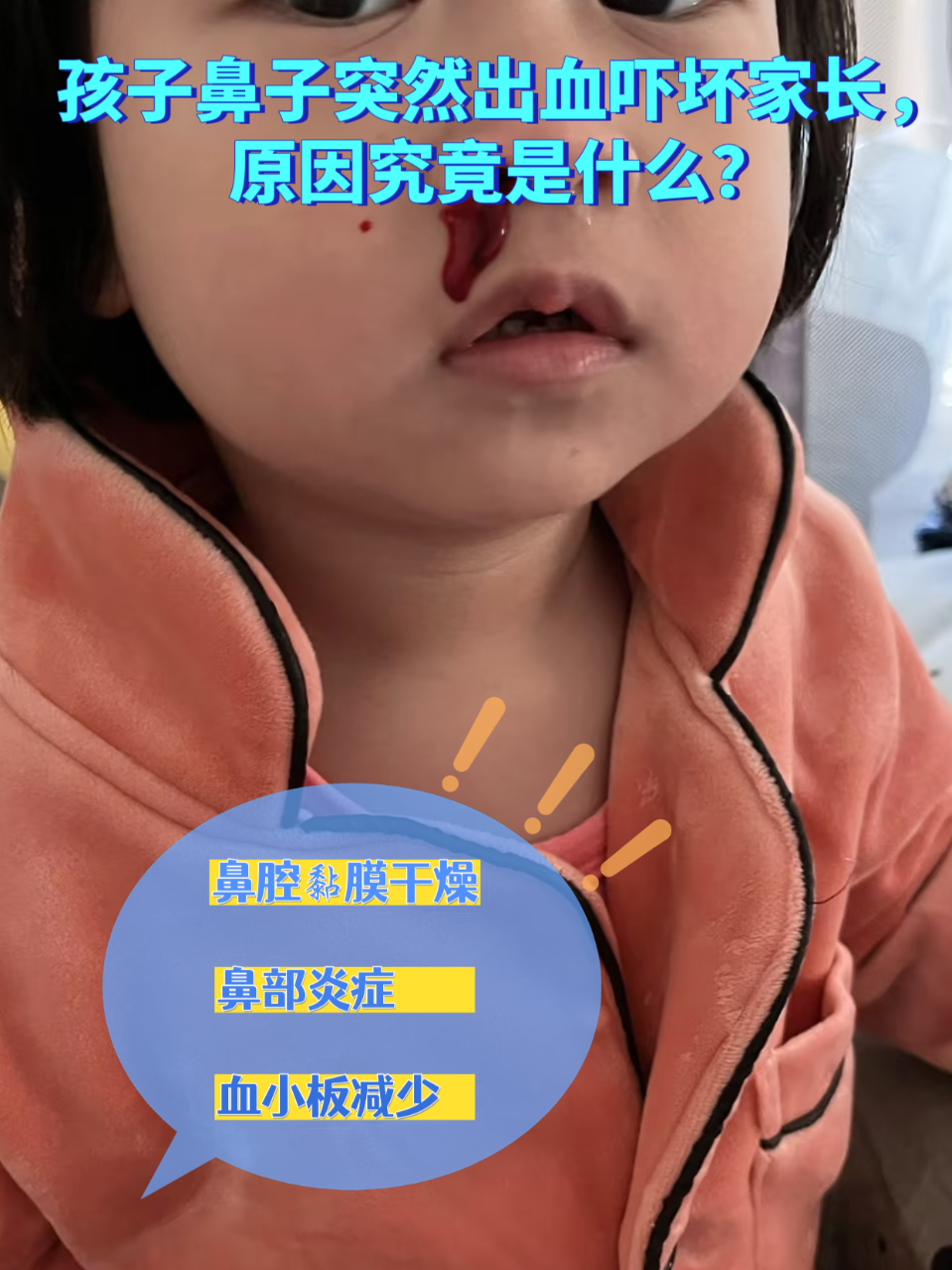 左鼻子流血是什么原因