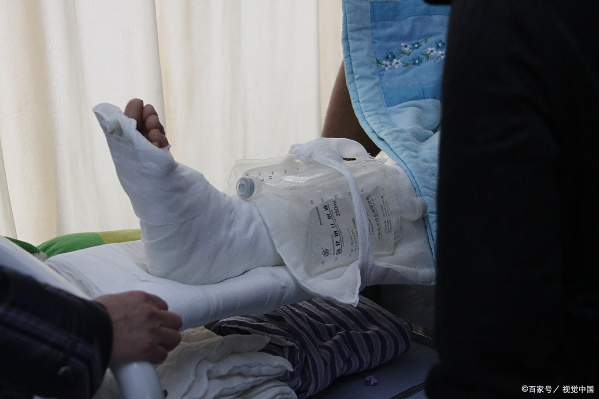 骨折的后遗症有哪些?