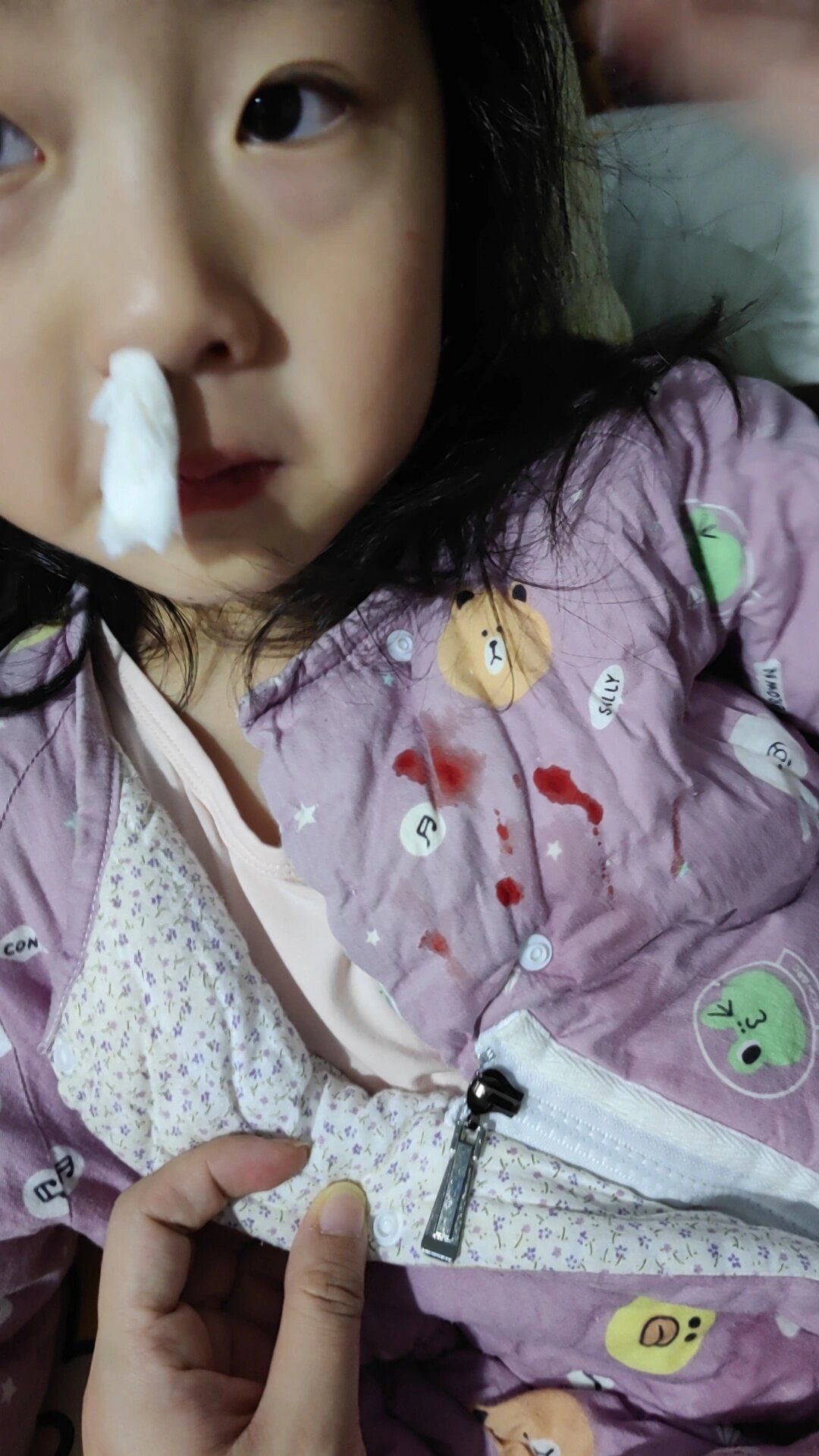 三岁小孩流鼻血