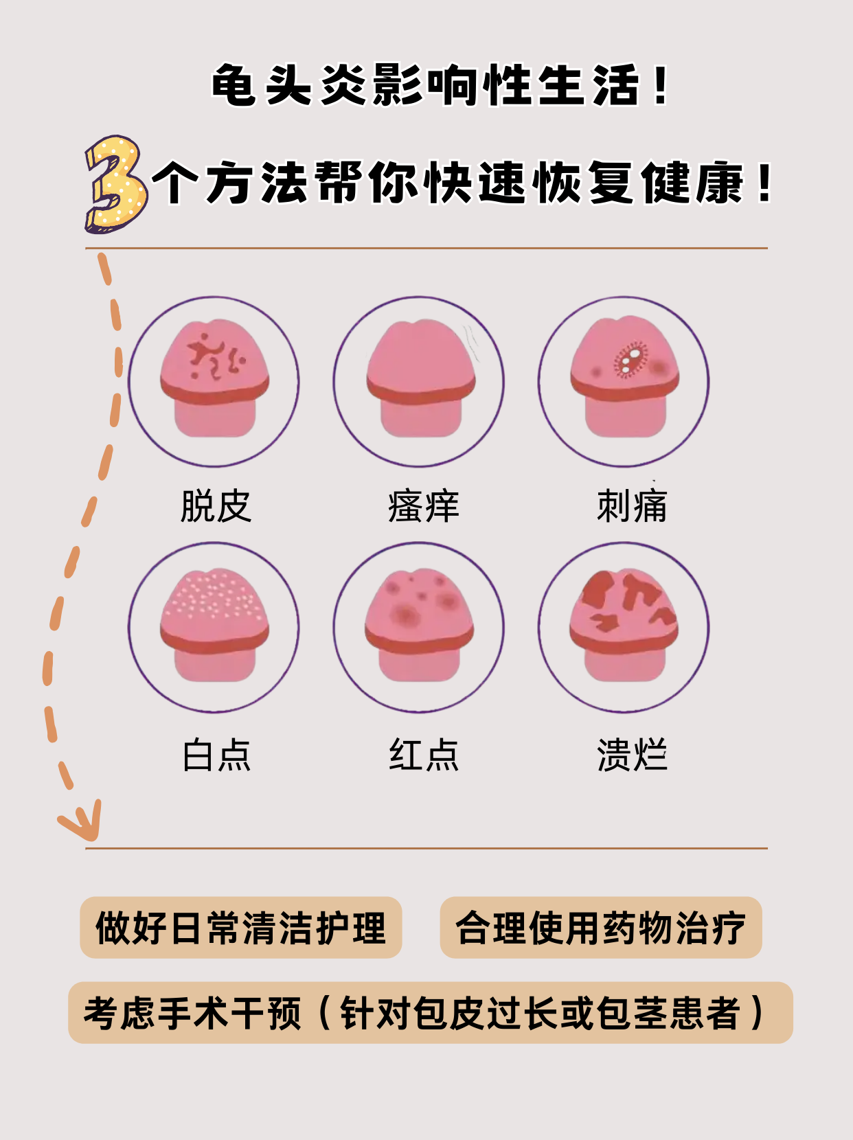 龟头湿疹怎么治疗