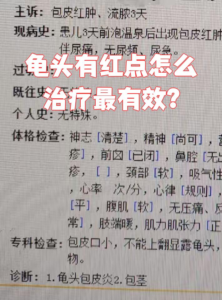 龟头湿疹怎么治疗