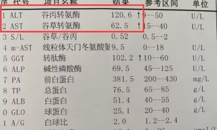 转氨酶高的症状是什么?