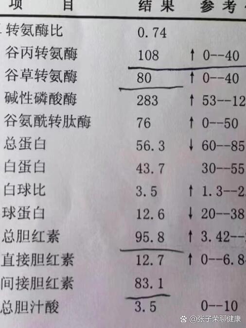 转氨酶高的症状是什么?