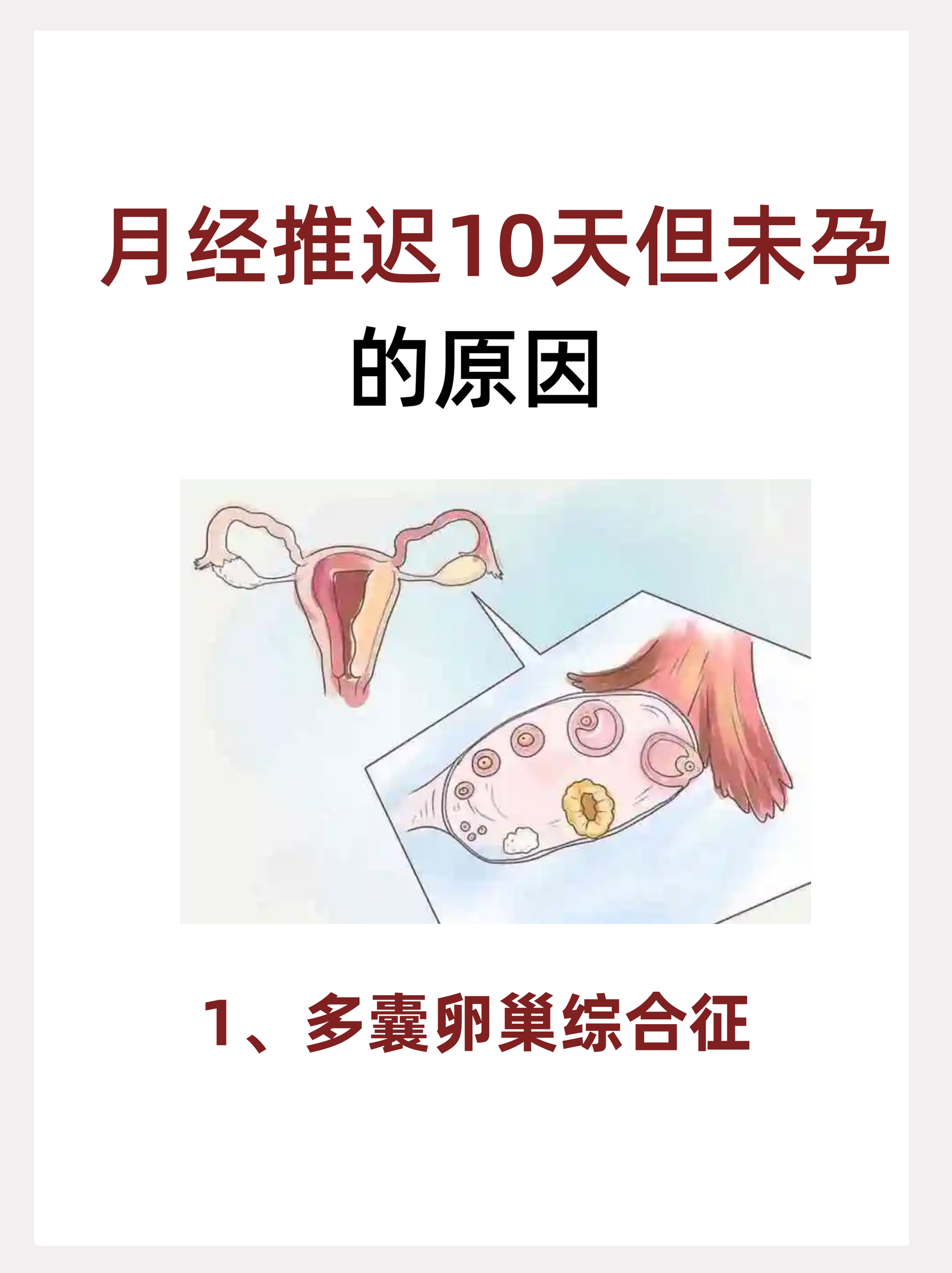 不排卵的原因有哪些