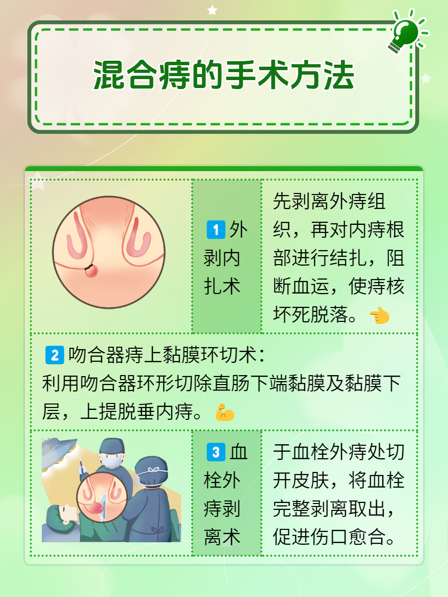内痔疮怎么治疗