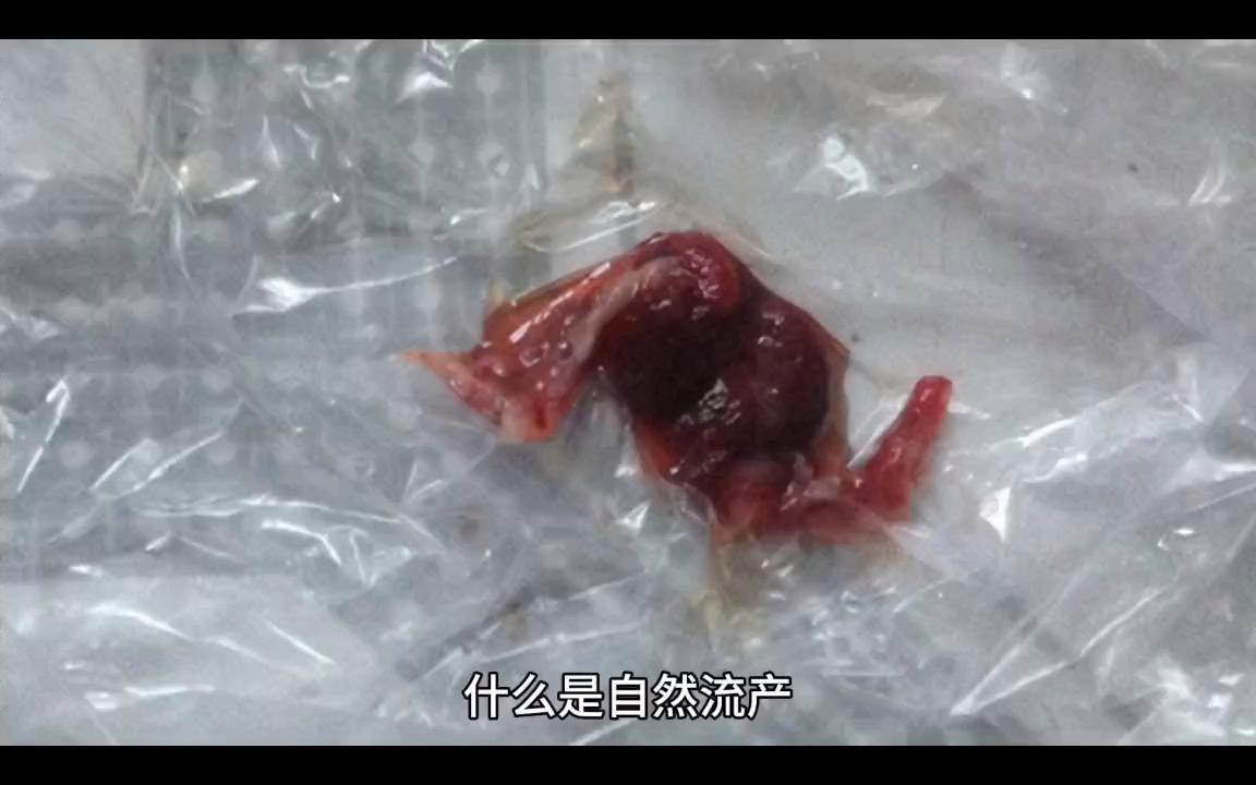 自然流产是什么意思