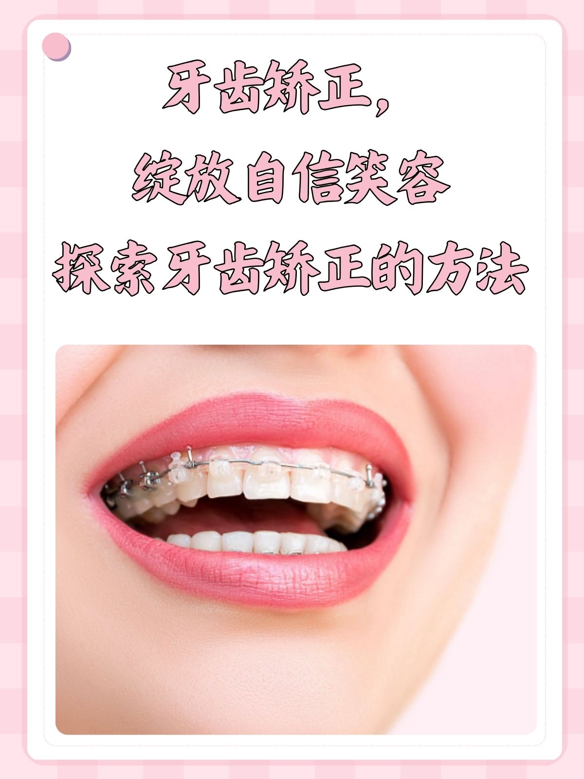 三十岁能做牙齿矫正吗