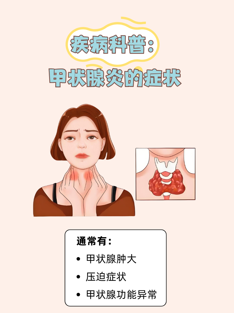 甲状腺病有哪些症状