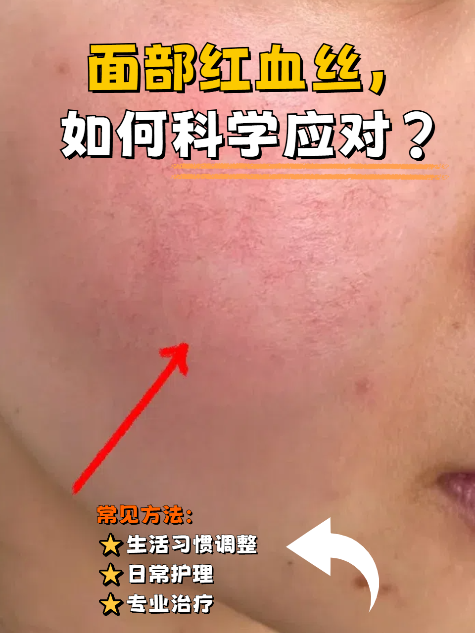 脸部潮红怎么治