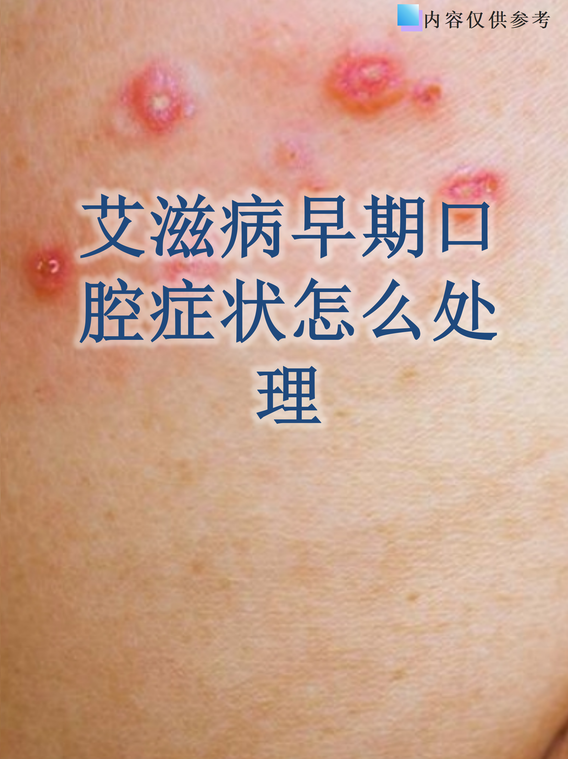 艾滋病早期的症状