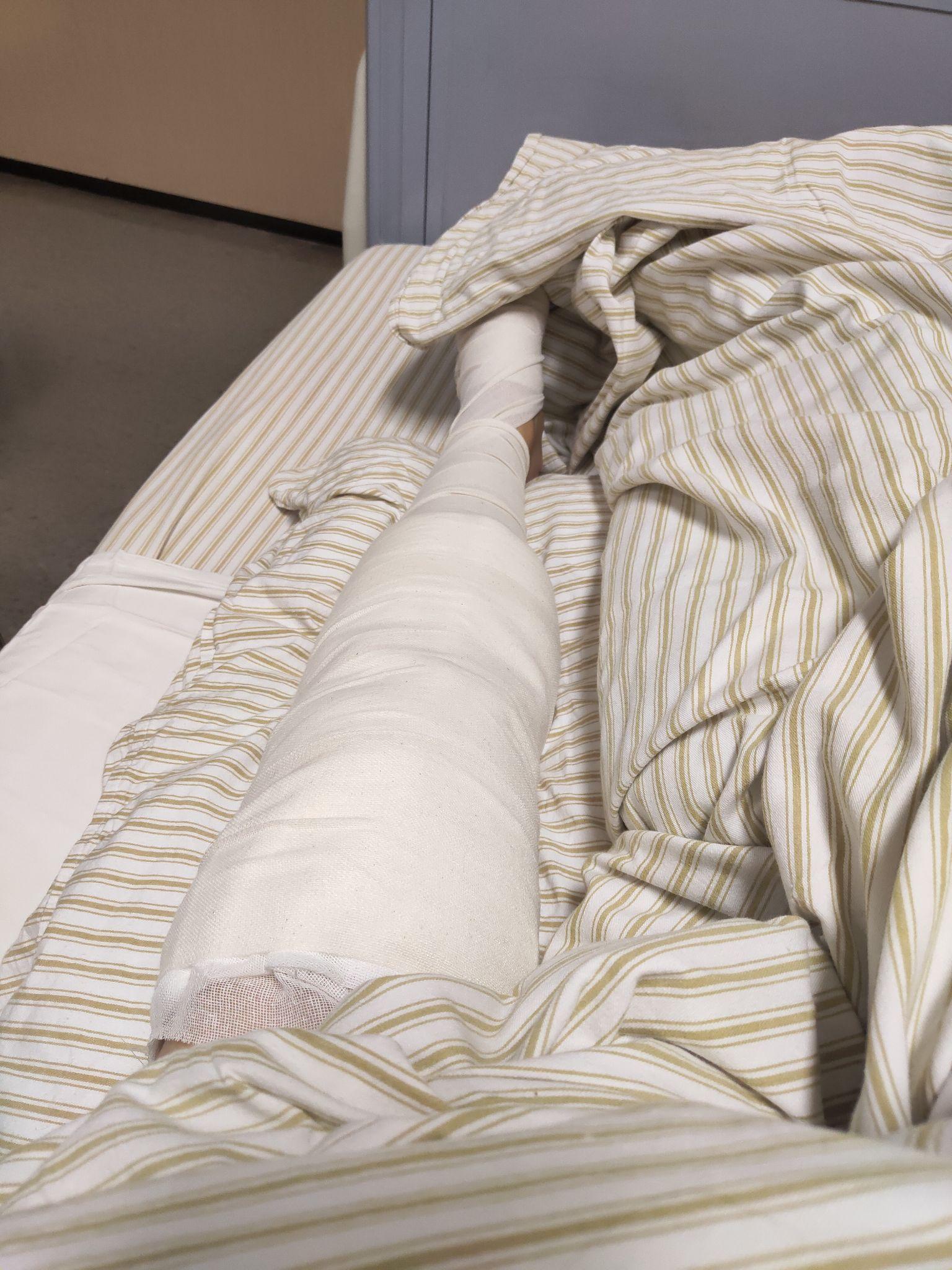 半月板损伤关节镜手术多少钱