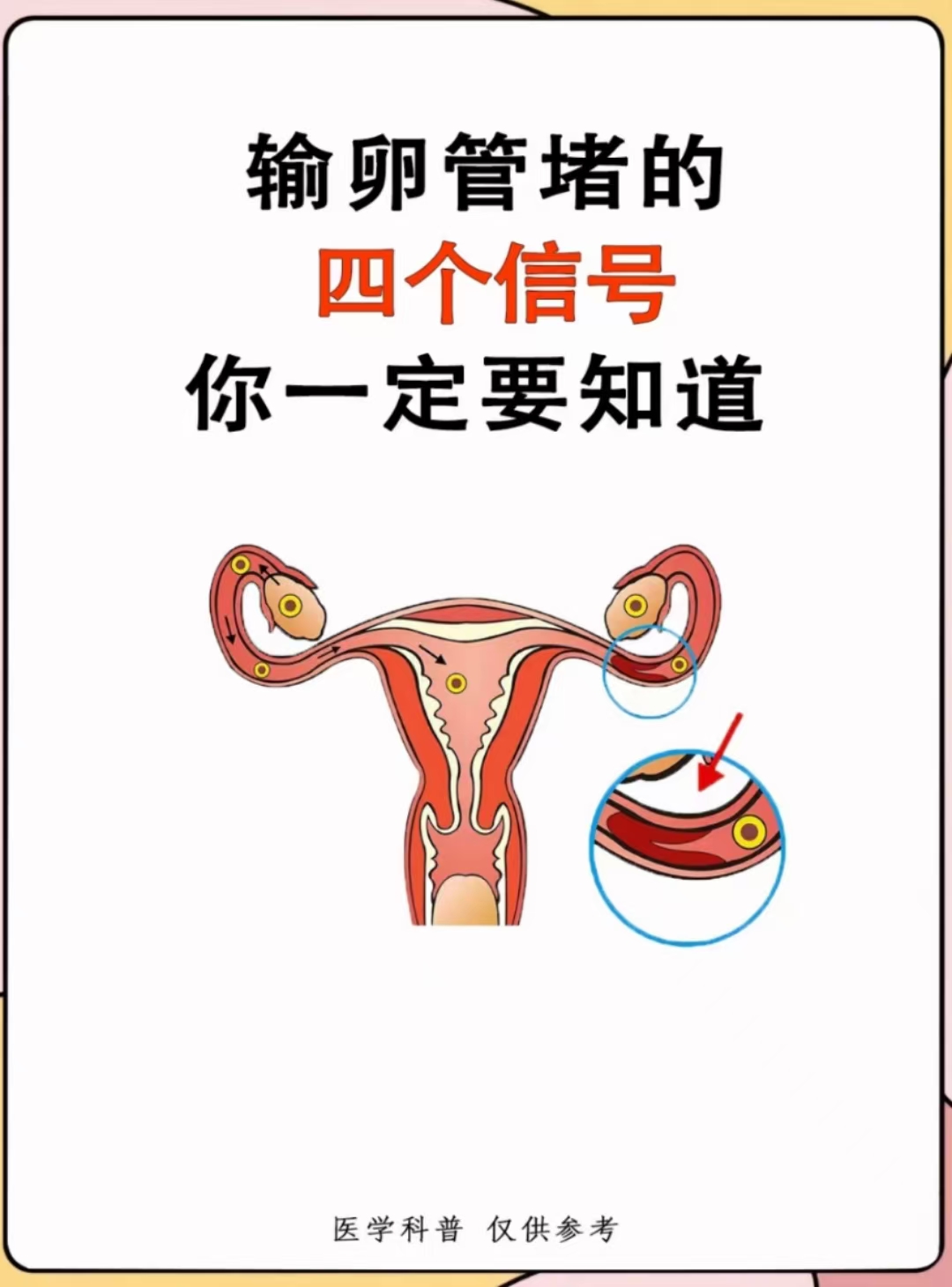 输卵管堵塞怎么办