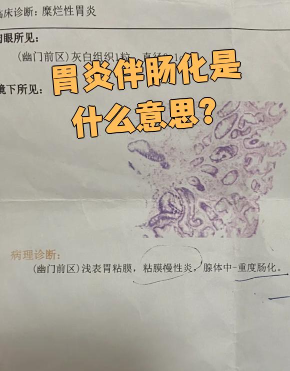 慢性萎缩性胃炎伴肠化能治好吗?