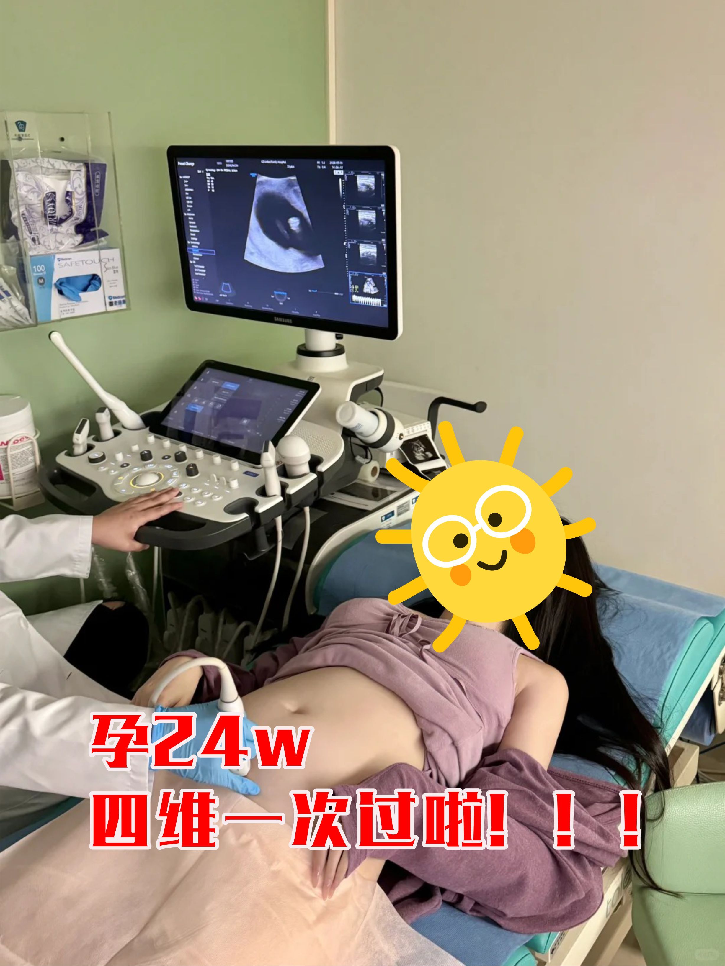 四维彩超要空腹吗