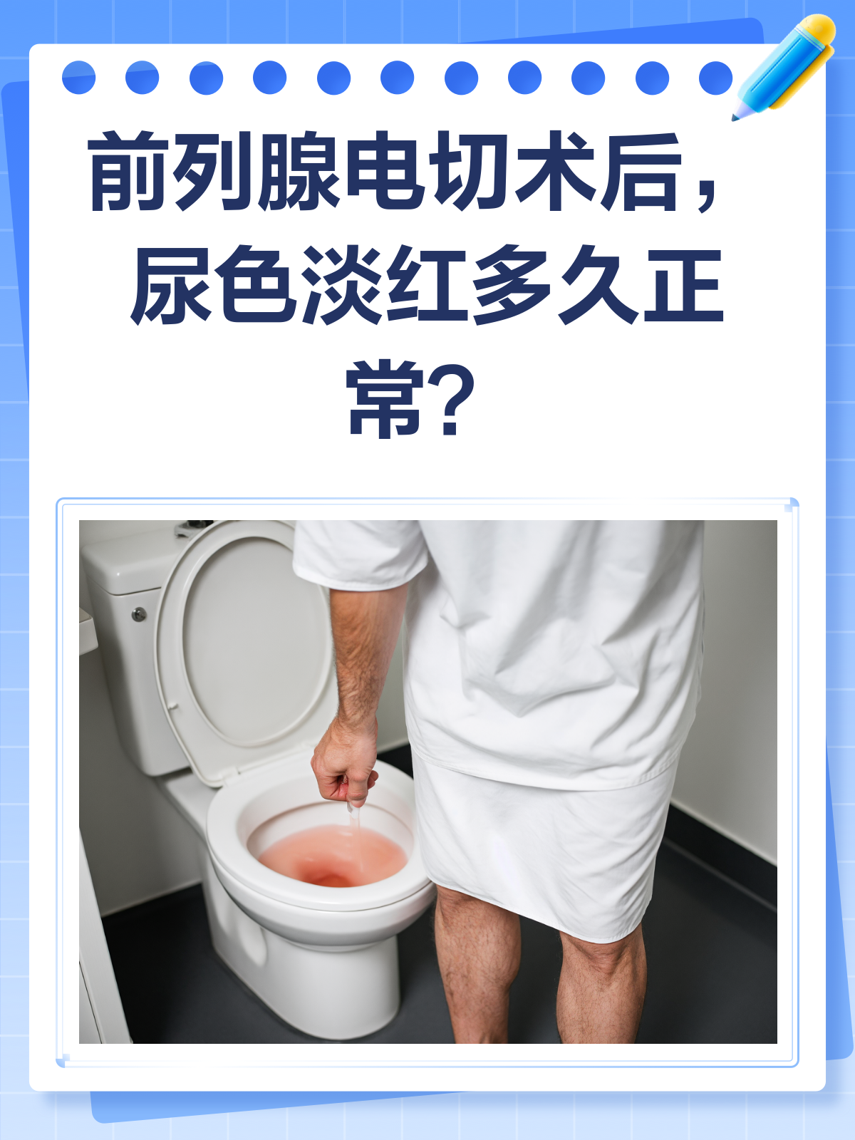 前列腺液是什么