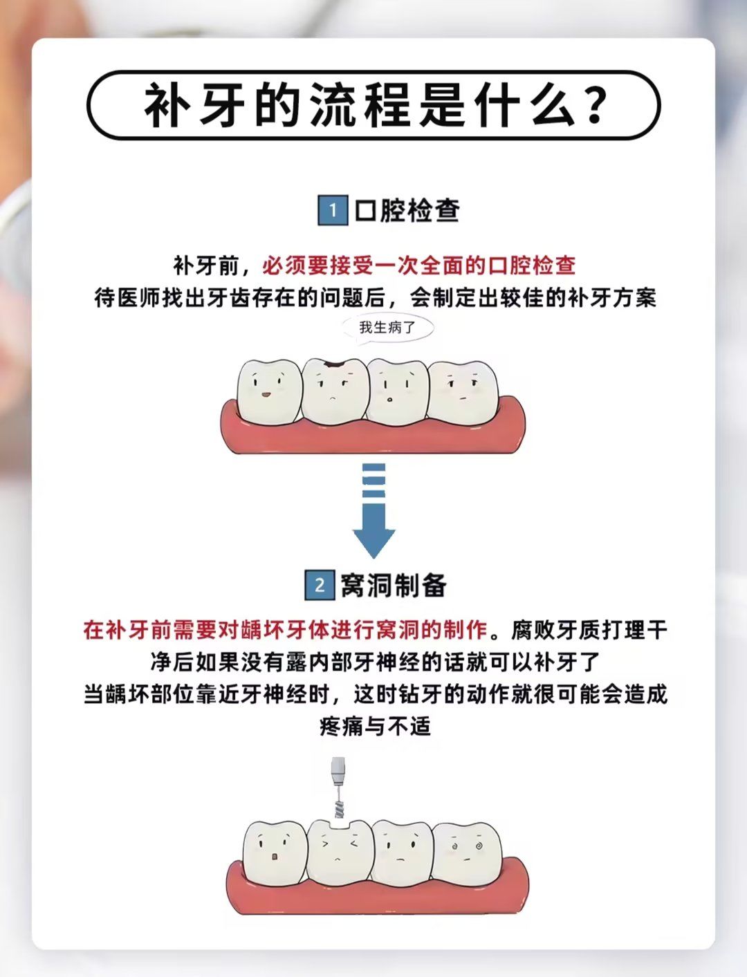 补牙痛不痛啊