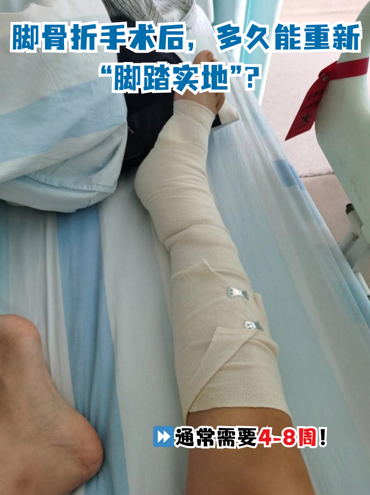 脚踝骨折手术后多久能走路