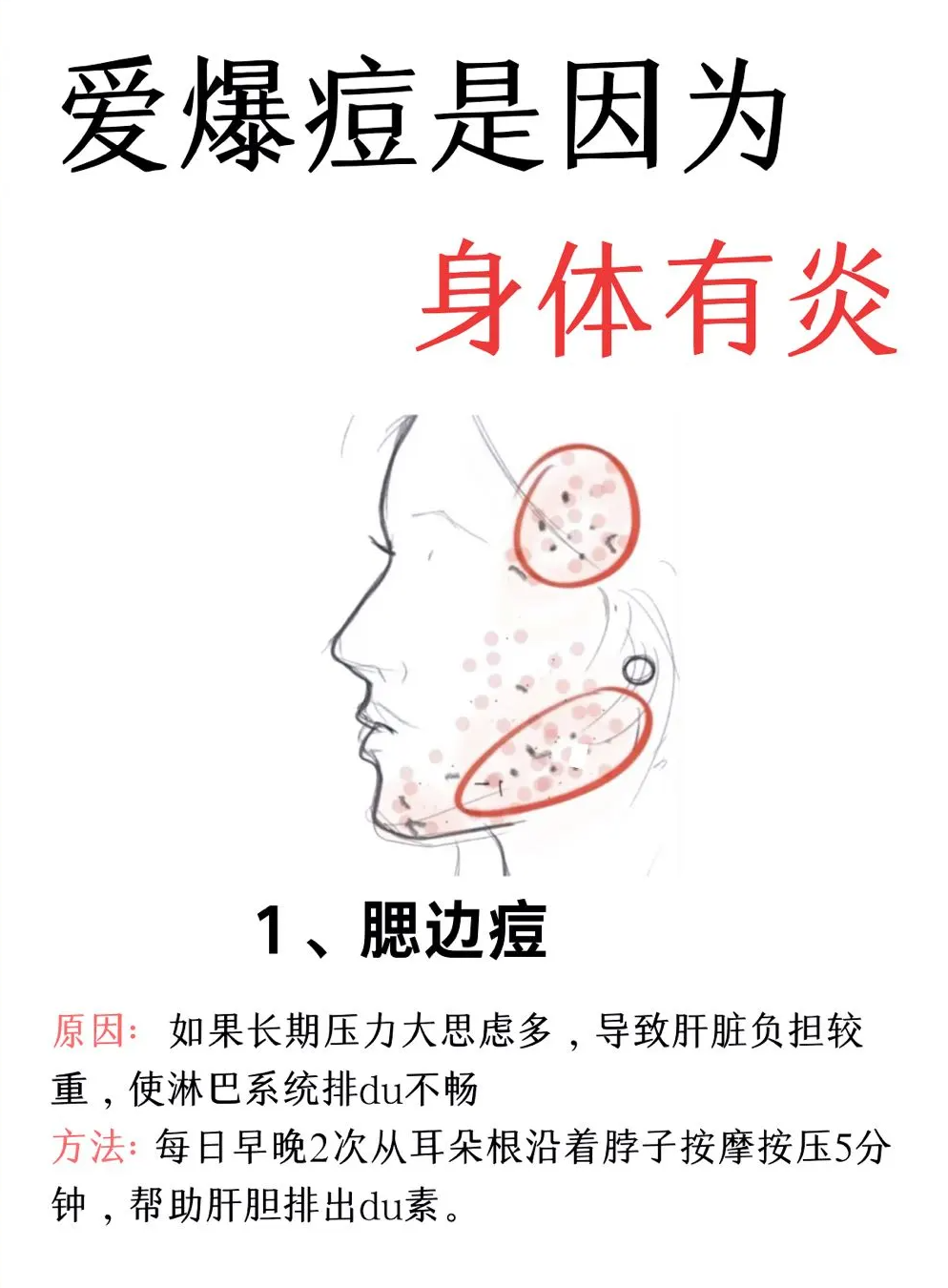 下巴上长痘痘是什么原因?