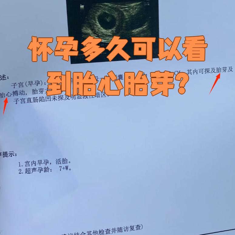 胎心140是男是女