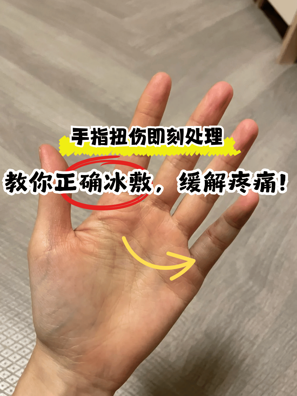 手关节炎怎么治疗